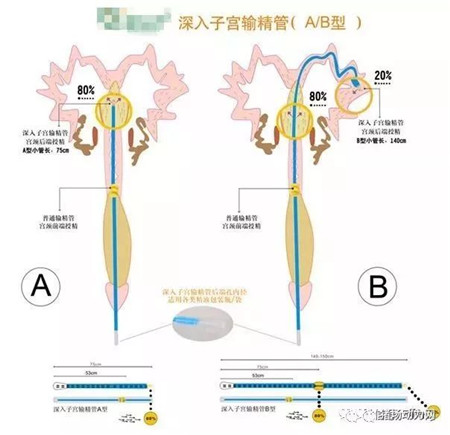 配种注意这个动作,不仅提高配种率,一窝还能多产一头