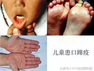 泔水养猪“低本巨毒”,为了您和家人的健康,请注意